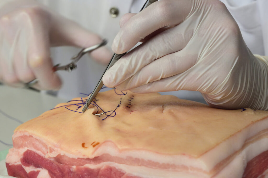 A medical student practicing skin sewing on pork skin