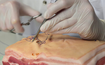 Top 5 Uses for Porcine Skin Grafts