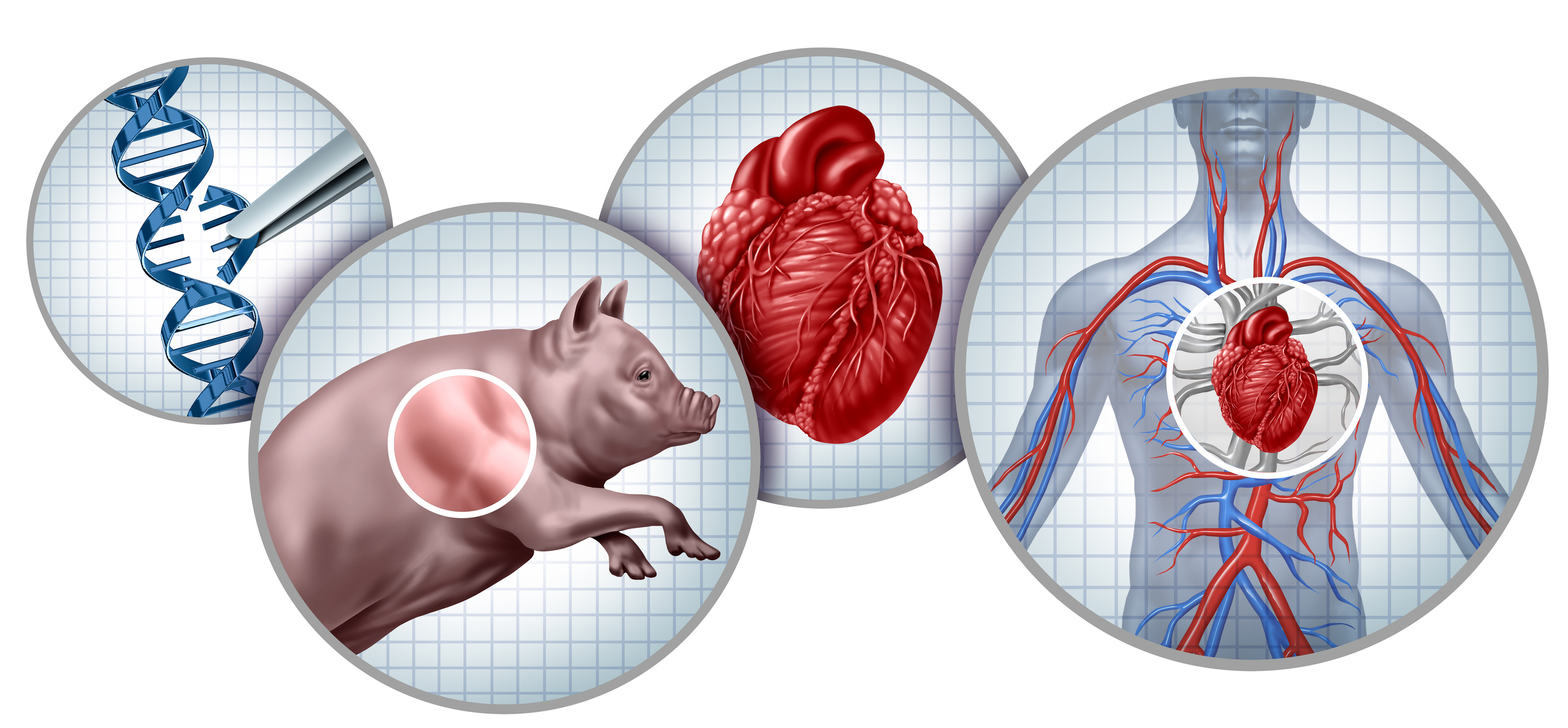 Pig to Human Heart Transplant visualization 